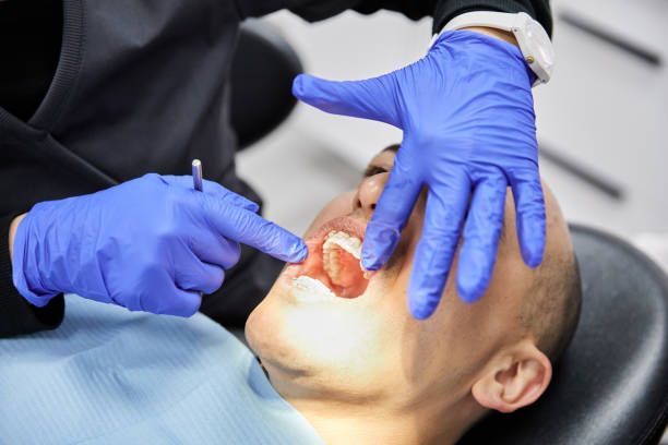 Best Broken or Cracked Tooth Emergency Dentist in Laurel Springs, NJ